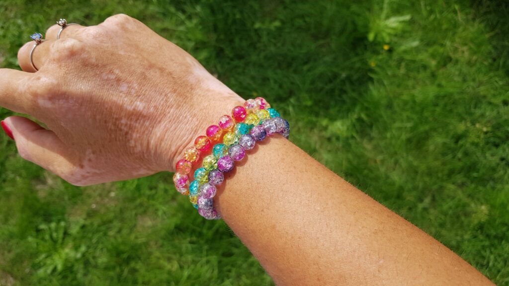 Un bracelet dont la couleur reflète l’état intérieur afin d’anticiper/prévenir toute crise